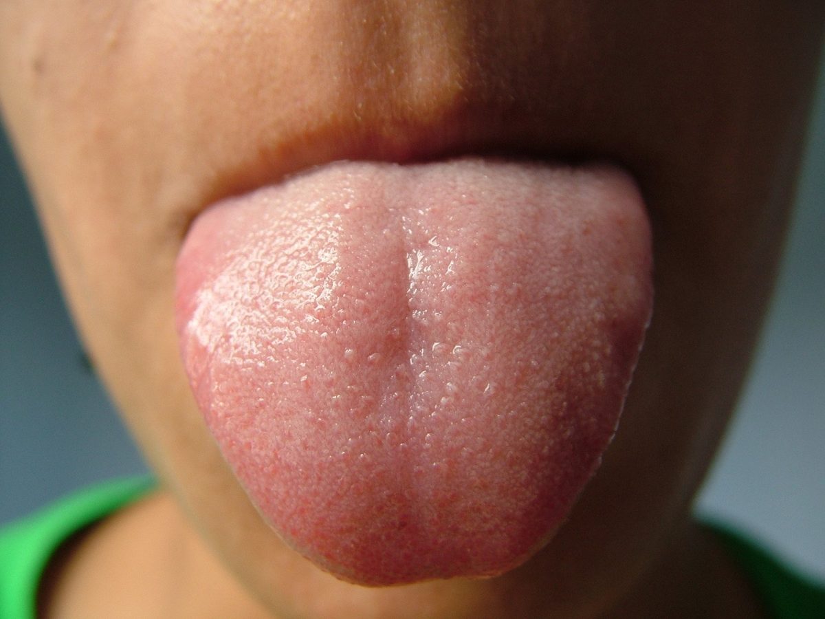 white tongue thrush