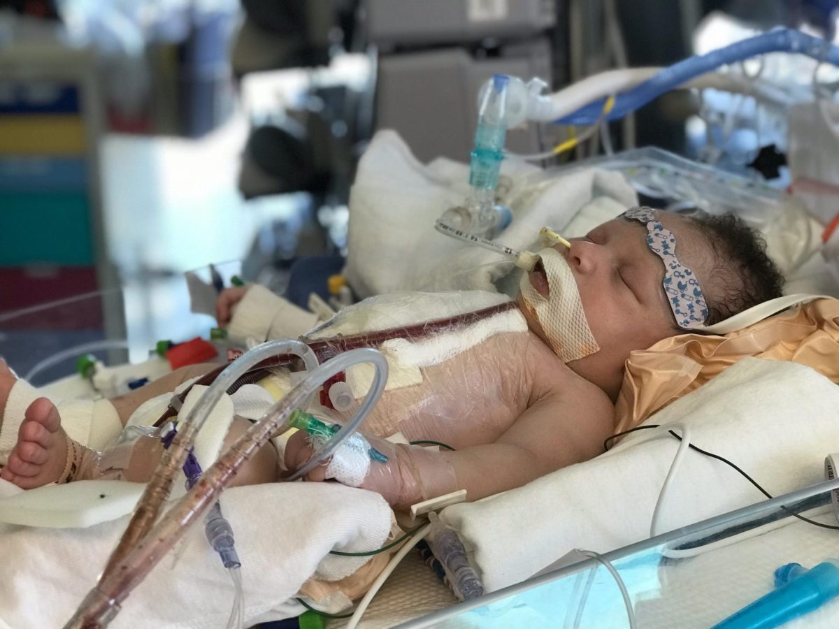 Neonatal intensive care unit baby