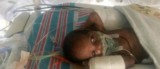 premature baby in incubator