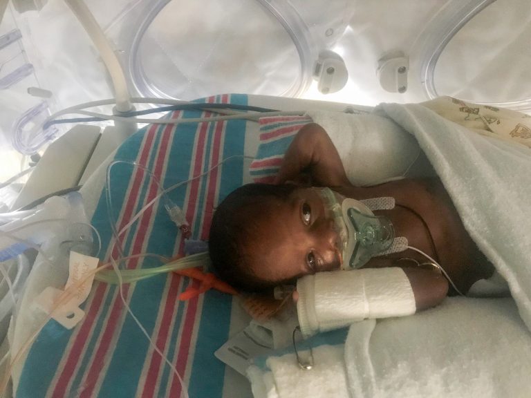 premature baby in incubator