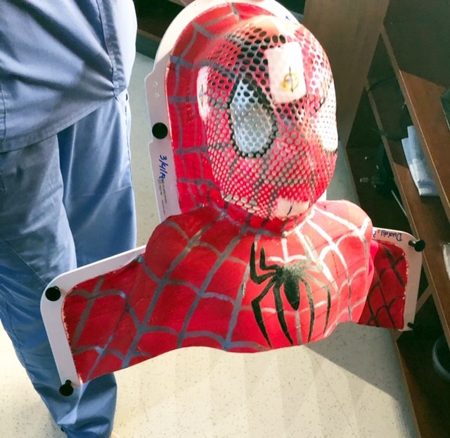 Spider-man mask used for radiation therapy treatment