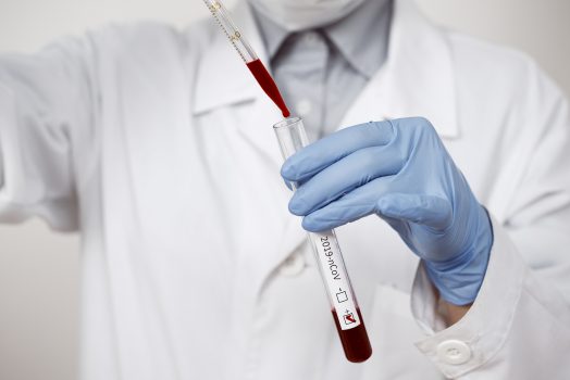 Lab test vial