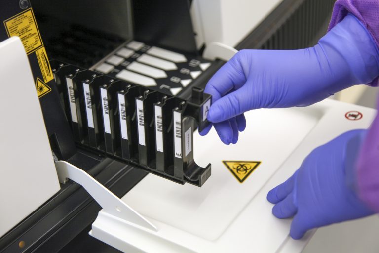 A person wearing gloves and conducting an antibody test.