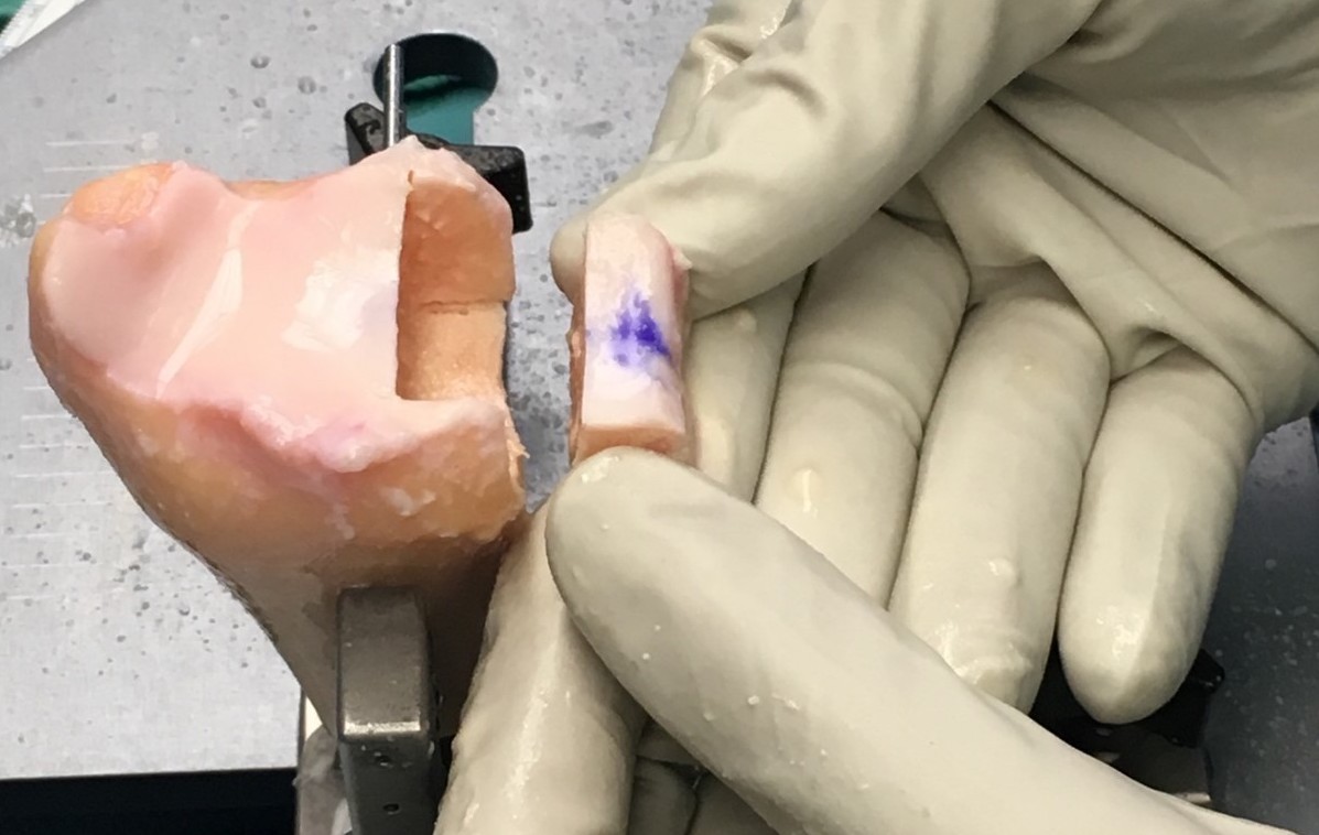 gloved hands holding piece of shoulder