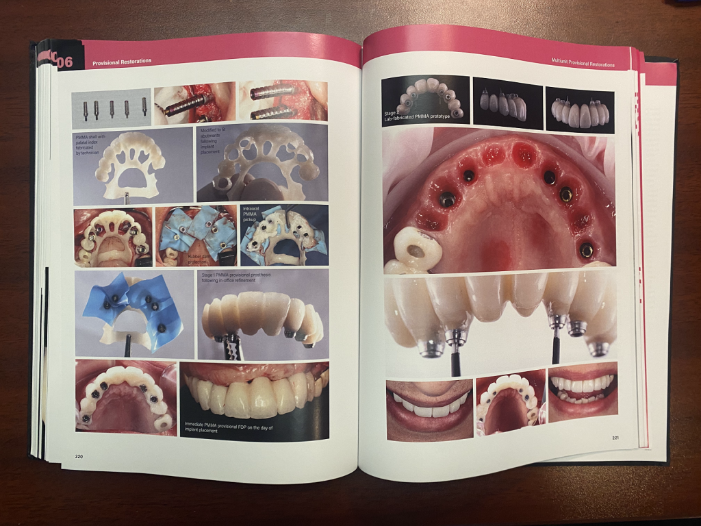 spread of a textbook