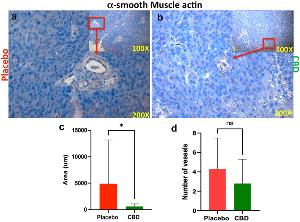 Imaging from microscope of tumor cell growth