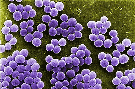 a microscopic view of bacteria appearing like clusters of purple circles edged in white against a mossy green background