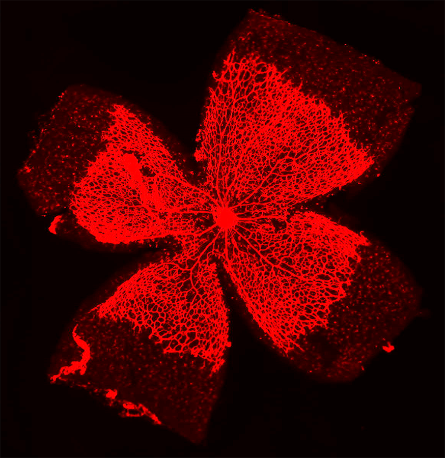 A microscopic view of a retina showing the formation of new blood vessels.