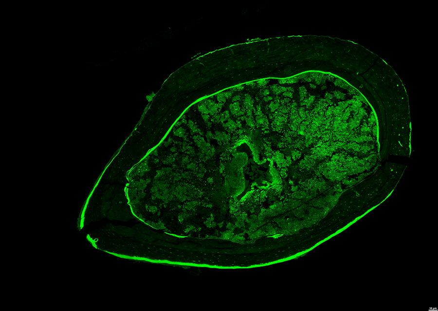 A microscopic view of a cross-section of the cortical bone.