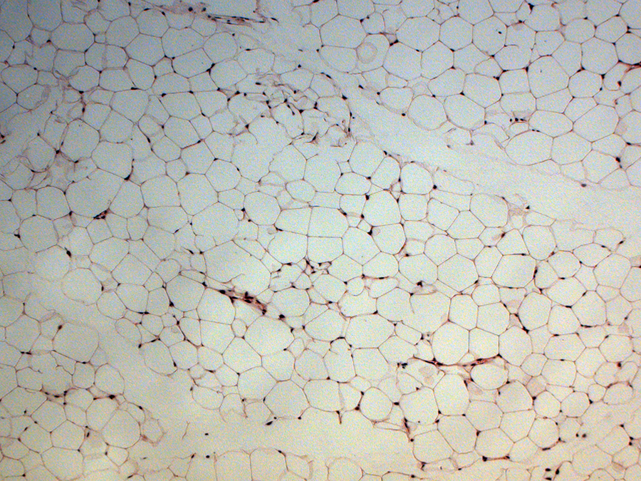 A microscopic view of a cross-section of fat tissue.