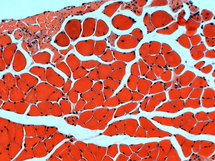 A microscopic view of a cross-section of muscle tissue.