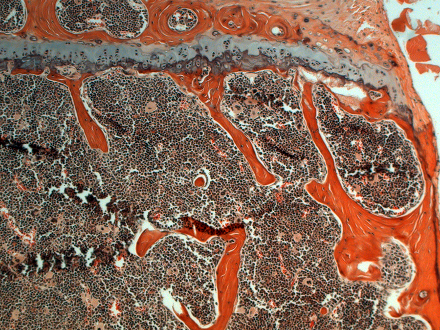 A microscopic view of a cross-section of a trabecular bone.