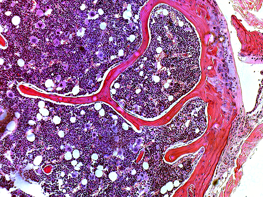 A microscopic view of a cross-section of the trabecular bone.