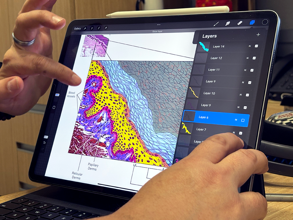 A pair of male hands using software on an iPad to illustrate a drawing of human tissue.