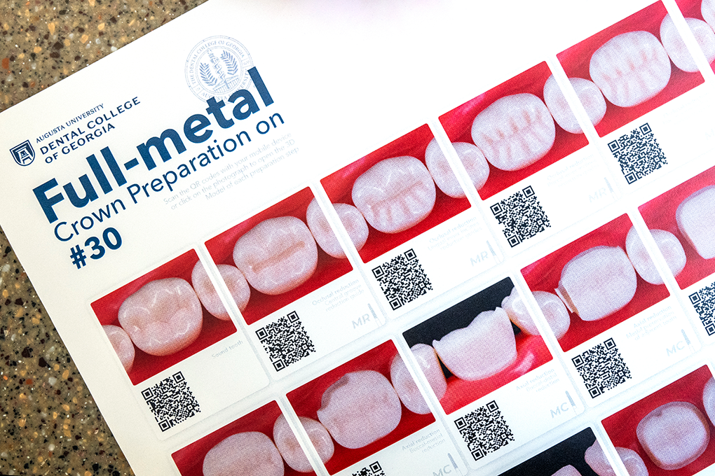 A sheet of paper shows the steps needed to prepare a molar for a full-metal crown.