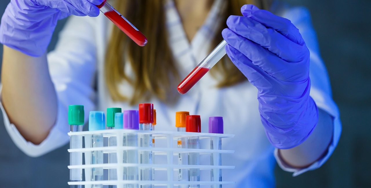 Scientist in lab with test tubes