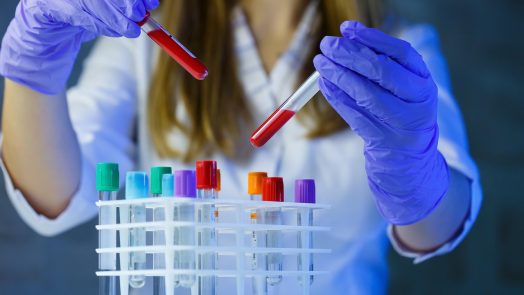 Scientist in lab with test tubes