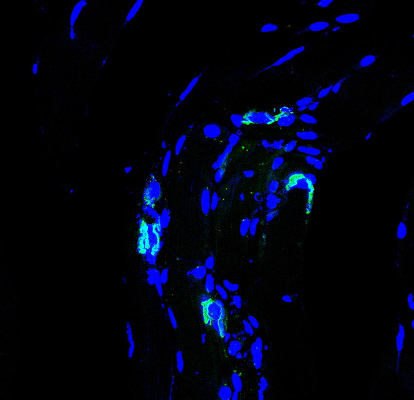 Images of skeletal muscle