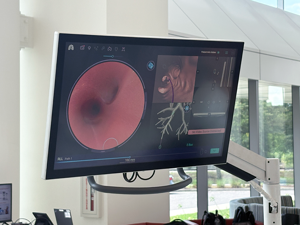 A tv monitor displays the inside of an airway.