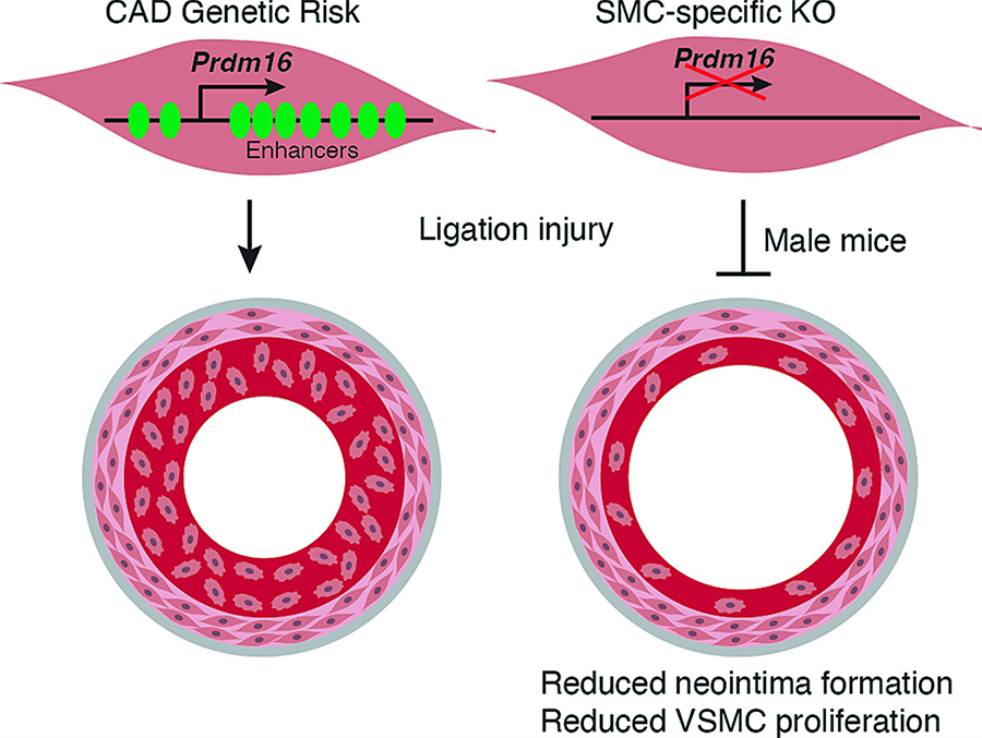 A graphic depicting human arteries during a cardiovascular event. One has a gene called PRDM16 present and shows how the artery hardens and thickens, and the other shows that if PRDM16 is not present, the artery remains normal.