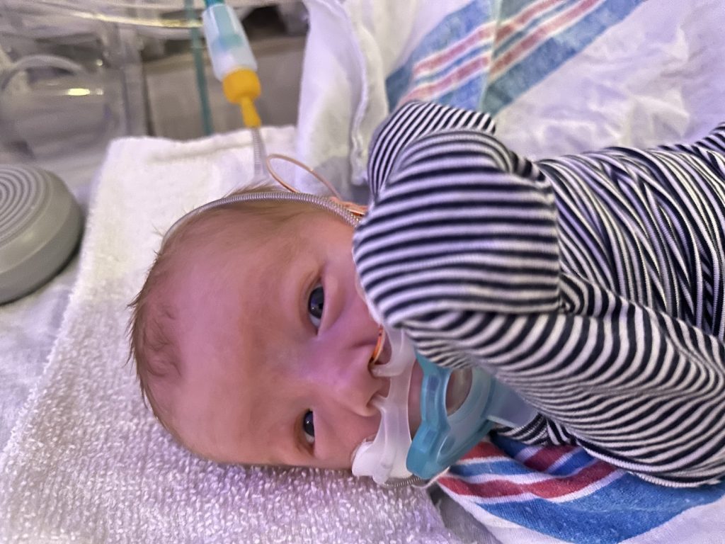 baby in the NICU